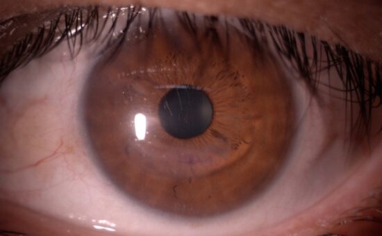 Primer plano de un ojo de color café
